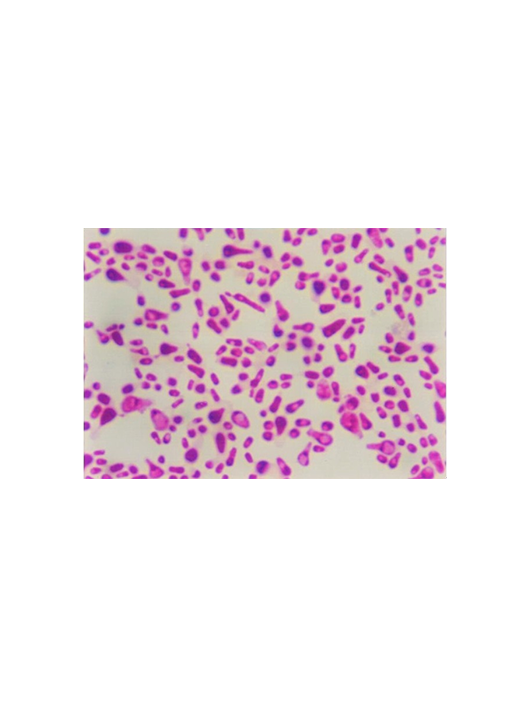 費比恩畢赤酵母