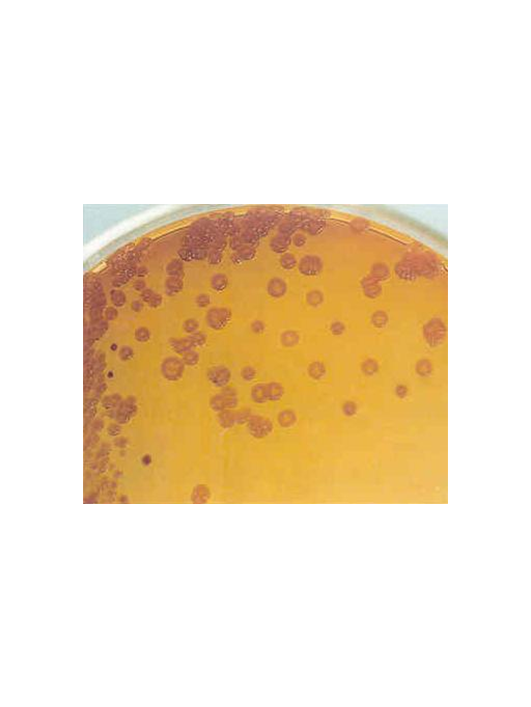 門多薩假單胞菌